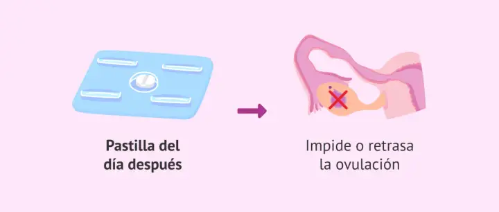 Pastilla del día después: su efecto es impedir o retrasar la ovulación, lo que puede afectar tu ciclo menstrual.
